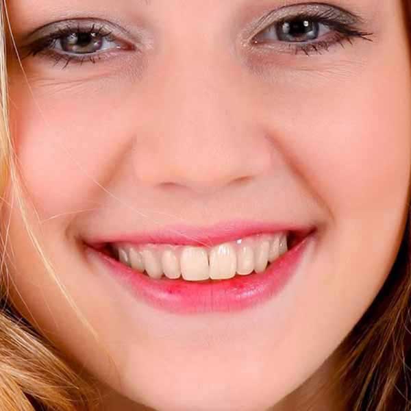Antes del tratamiento dental