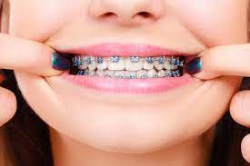 Servicio de implantes dentales
