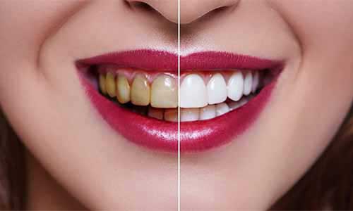 Servicio de endodoncia